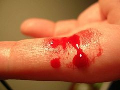 ošetriť drobné poranenia ako je krvácanie